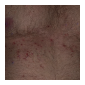 ../_images/examples_synderm_dataset_17_1.png