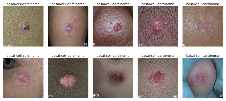 ../_images/examples_synderm_dataset_22_0.png